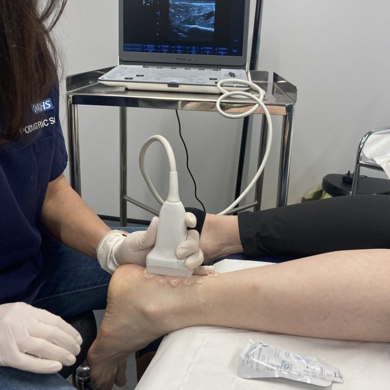 Col Pod Foot Pain Chesterfield - Colpod therapy
